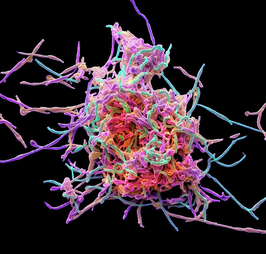 mycoplasma pneumonia