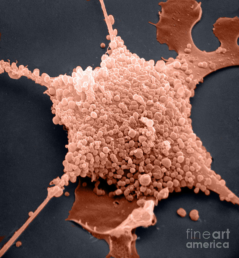 Mycoplasma Photograph - Mycoplasma, Sem by David M. Phillips