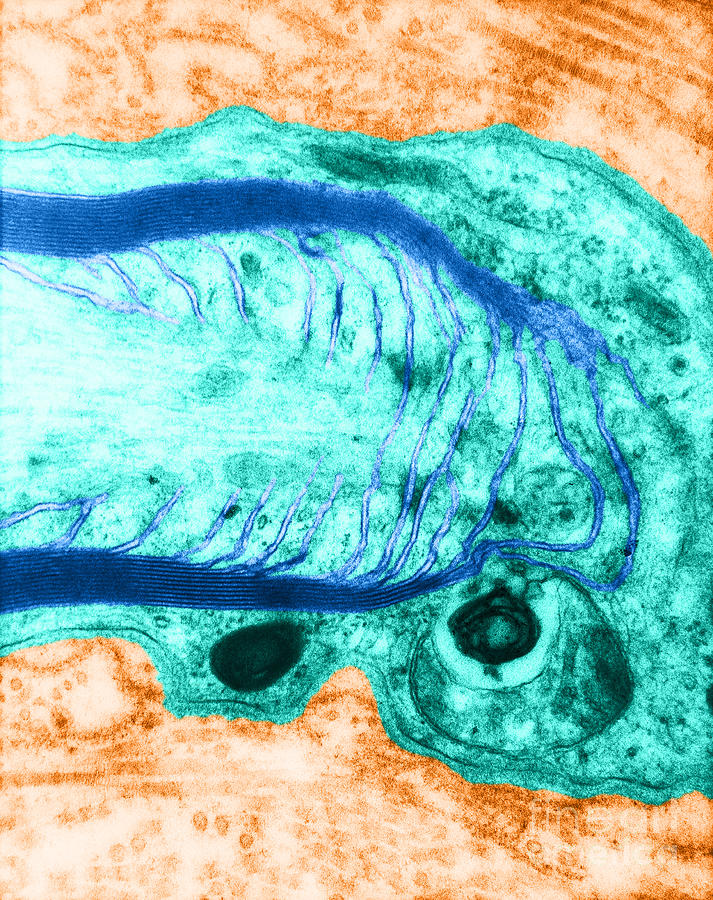 Microscopy Photograph - Myelin In Nerve Cell, Tem by David M. Phillips