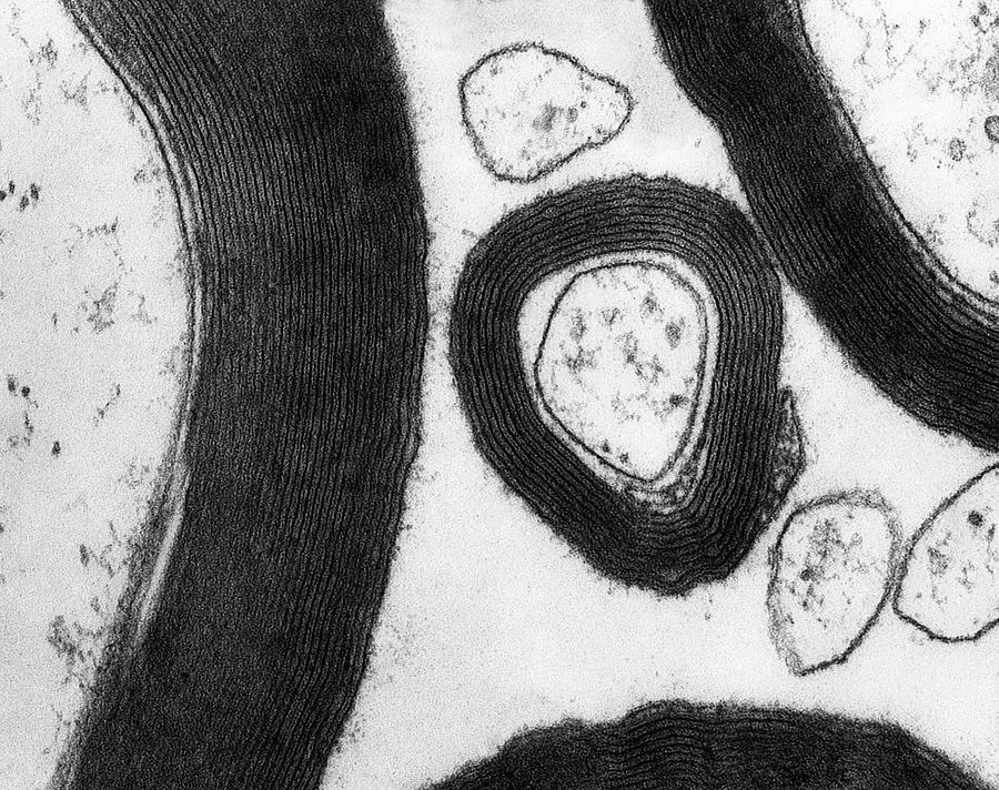 Axon Photograph - Myelin Sheaths Surrounding Axons Cns by Dennis Kunkel Microscopy/science Photo Library