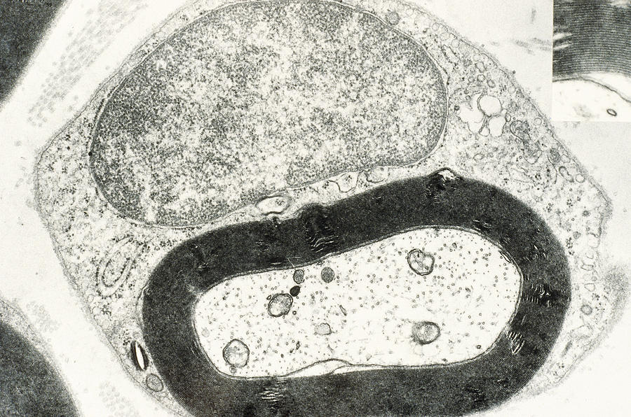 Myelinated Nerve Photograph by Biology Pics