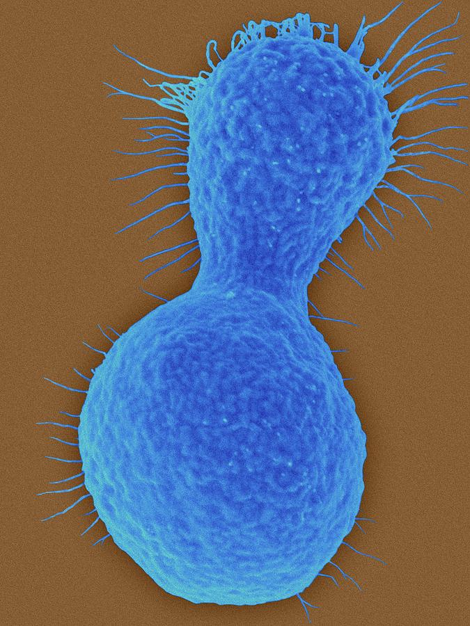 Myxozyma Mucilagina Ascomycetous Yeast Photograph by Dennis Kunkel Microscopy/science Photo Library