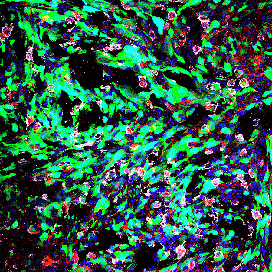 Cell Photograph - Nanoparticle Brain Cancer Therapy by Yale Cancer Center/national Cancer Institute/science Photo Library
