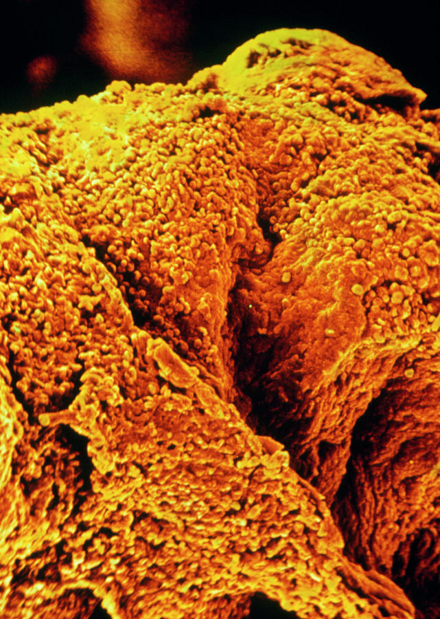 Nasal Photograph - Nasal Epithelium by Cnri/science Photo Library