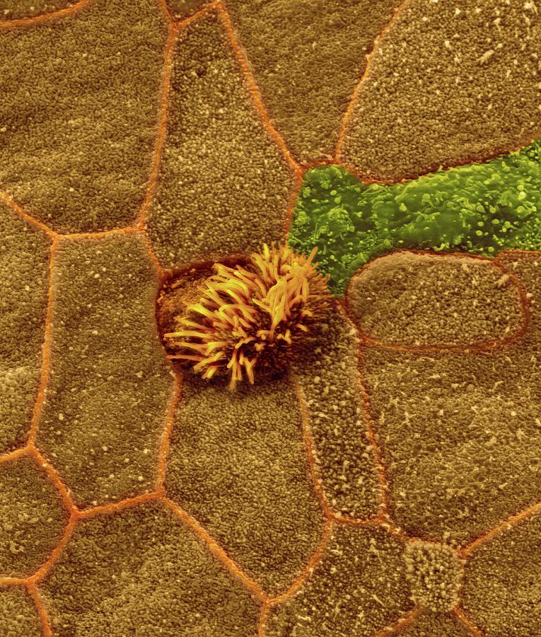 Nasopharynx Epithelial Surface Photograph by Dennis Kunkel Microscopy/science Photo Library