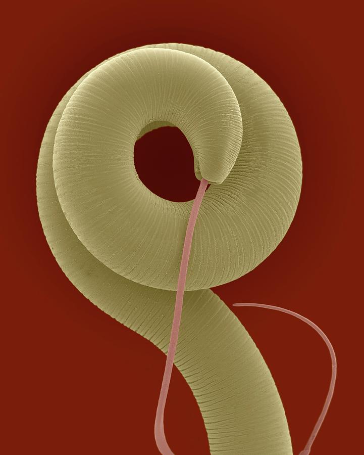 Nematode (trichuris Sp.) Helminth (whipworm) Photograph by Dennis Kunkel Microscopy/science Photo Library