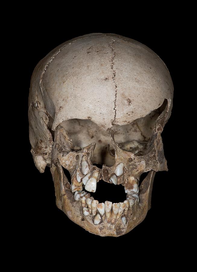 Neolithic Child's Skull Photograph by David Parker - Fine Art America