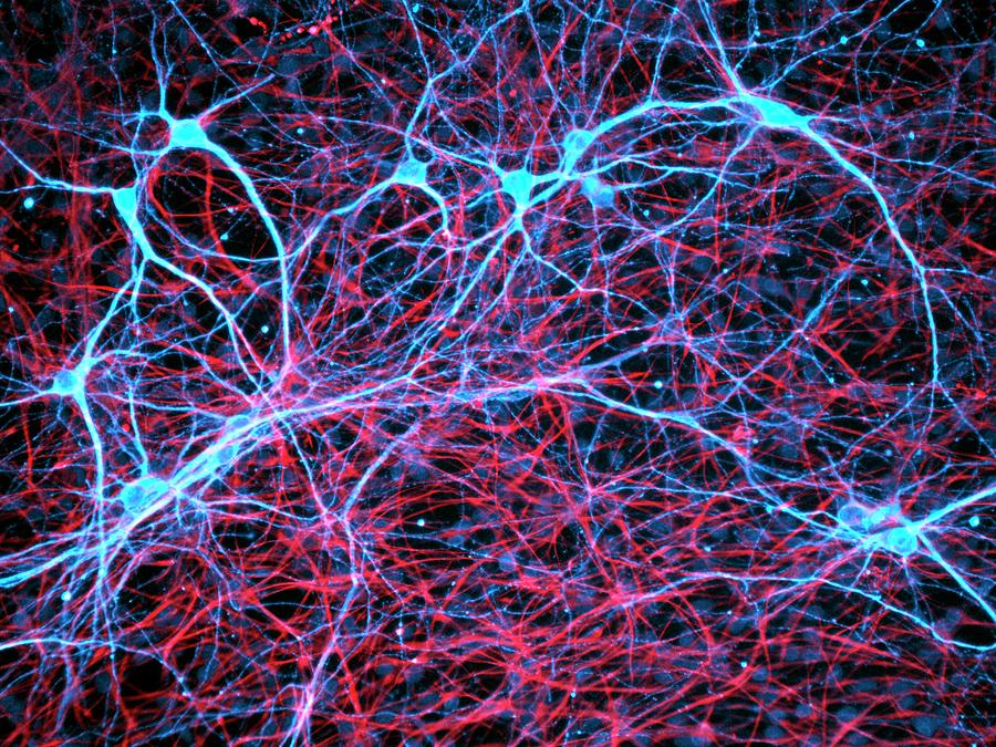 Nerve And Glial Cells Photograph by Daniel Schroen, Cell Applications Inc