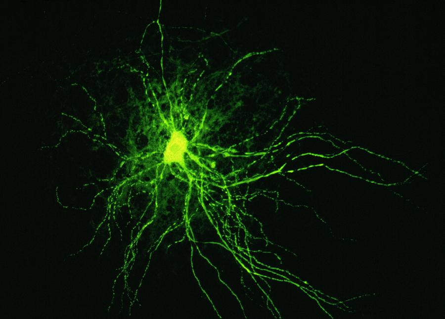 Nerve Cell Photograph by Cnri/science Photo Library