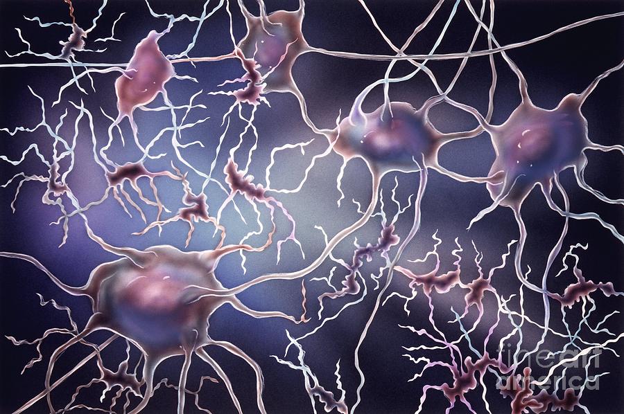 Nerve Cell Degeneration, Artwork Photograph by Bo Veisland