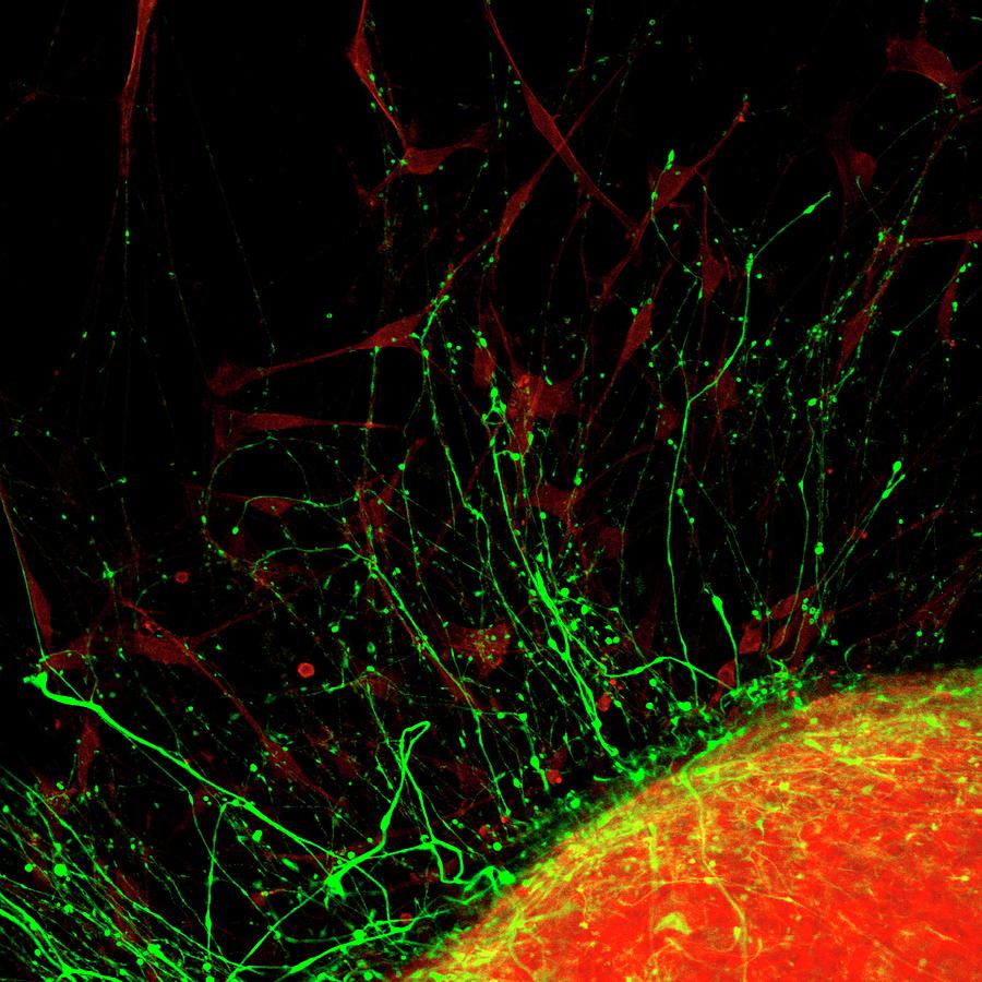 Nerve Cell Photograph by Kevin Mackenzie / University Of Aberdeen / Science Photo Library