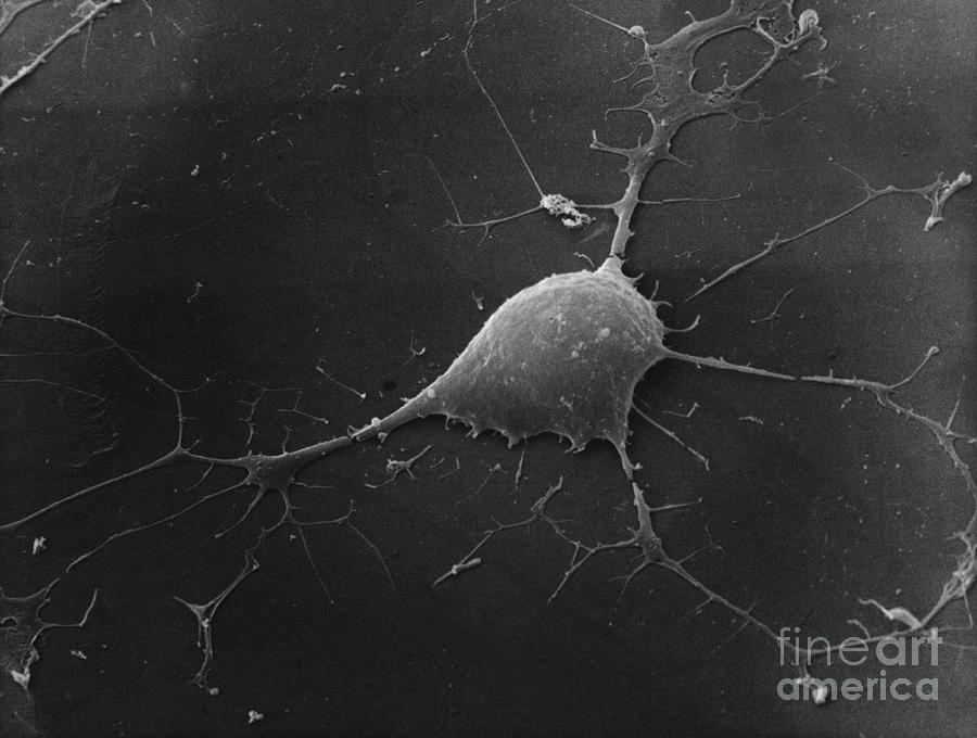 Nerve Cell Sem Photograph by David M. Phillips