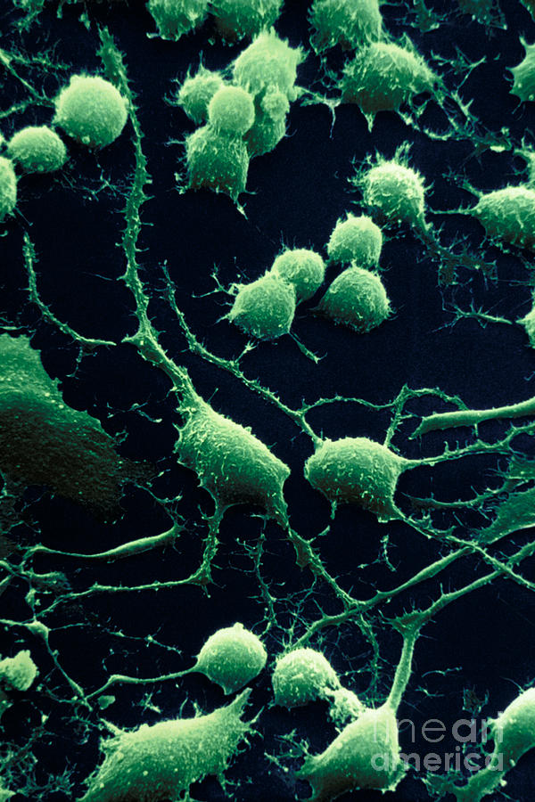 Nerve Cells Photograph by David M. Phillips