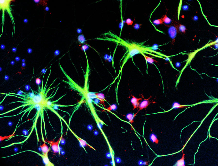 Nerve Cells Photograph by Nancy Kedershaucla
