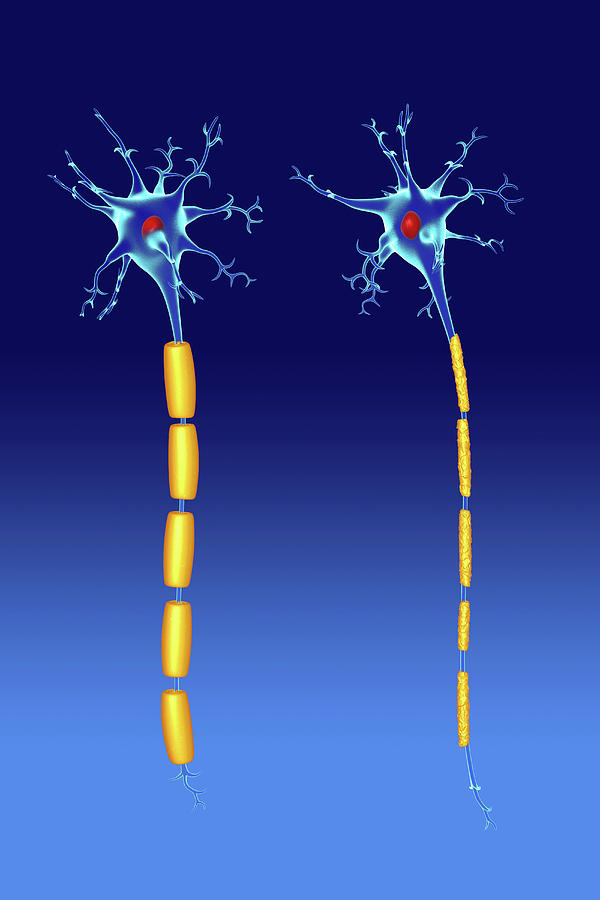Illustration Photograph - Nerve Cells by Roger Harris/science Photo Library