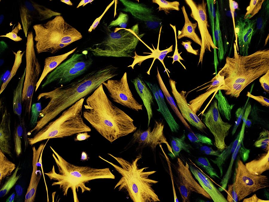 Neural Progenitor Cell Differentiation Photograph by Carol N. Ibe And Eugene O. Major/national Institutes Of Health
