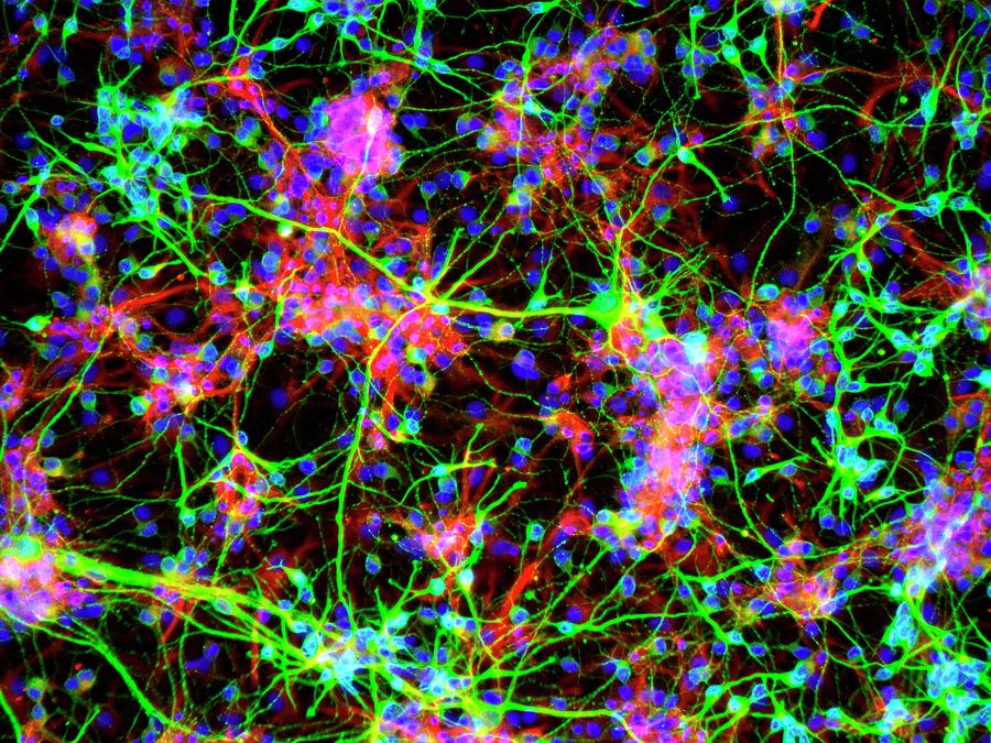 Neural Stem Cells Photograph by Daniel Schroen, Cell Applications Inc
