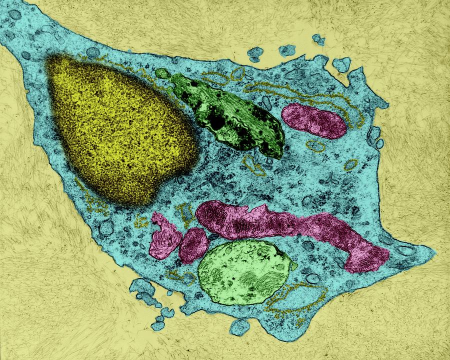 Neuroglia Cell Destroying Beta-amyloid Photograph by Dennis Kunkel Microscopy/science Photo Library