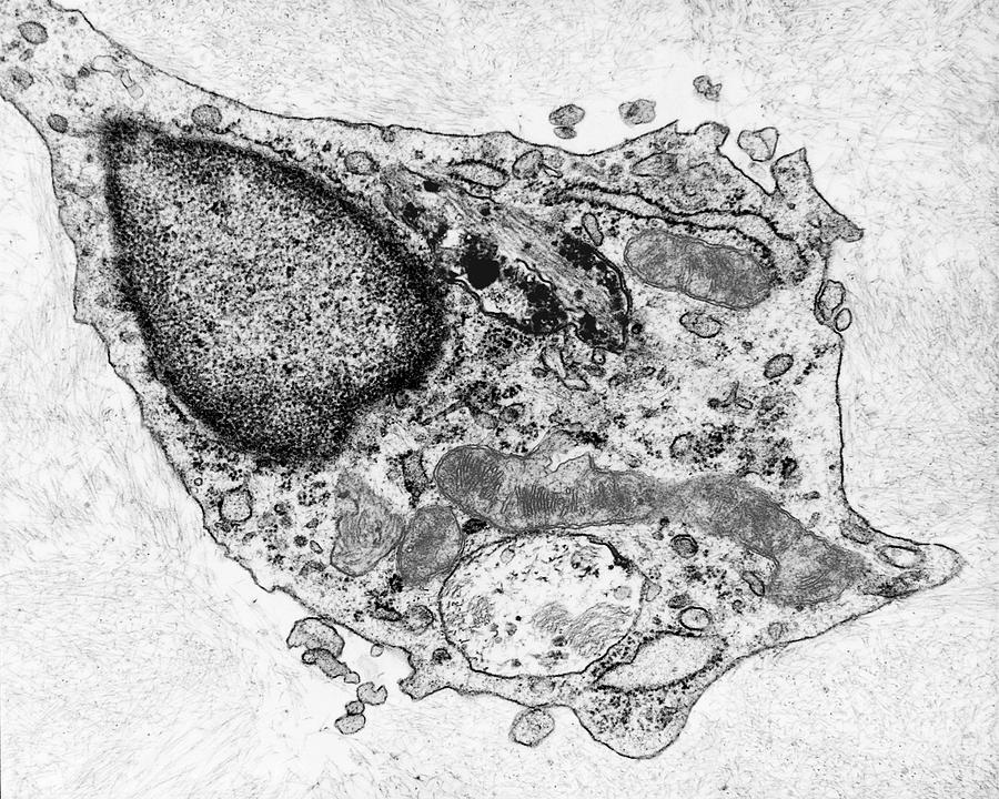 Neuroglia Cell Destroying Betaamyloid Photograph by Dennis Kunkel Microscopy/science Photo Library