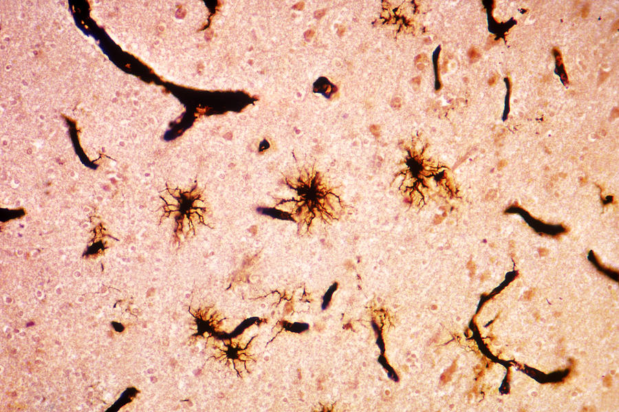 Neuroglia Photograph by Michael Abbey
