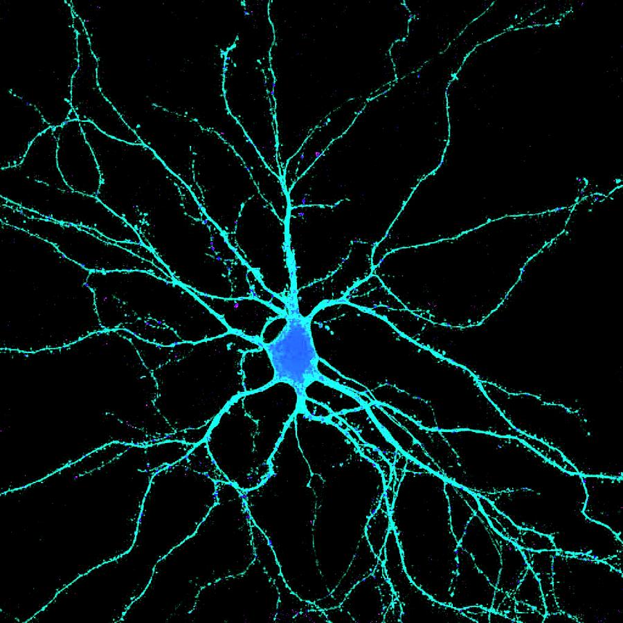 Neuron Photograph by Dr. Chris Henstridge