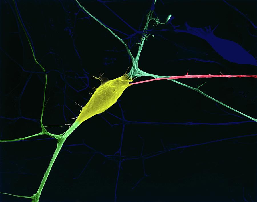 Axon Photograph - Neuron Growing In Culture by Dennis Kunkel Microscopy/science Photo Library