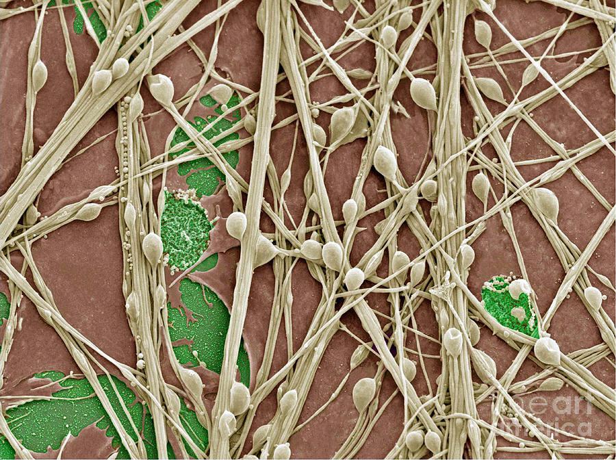 Neurons And Glial Cells, Sem Photograph by Science Source