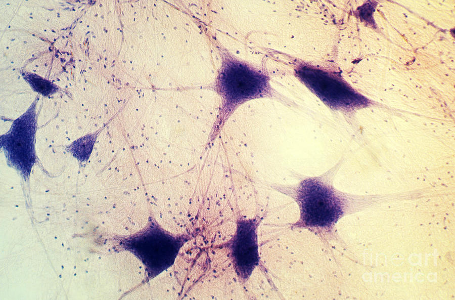 Neuron Photograph - Neurons In A Human Brain by David M. Phillips