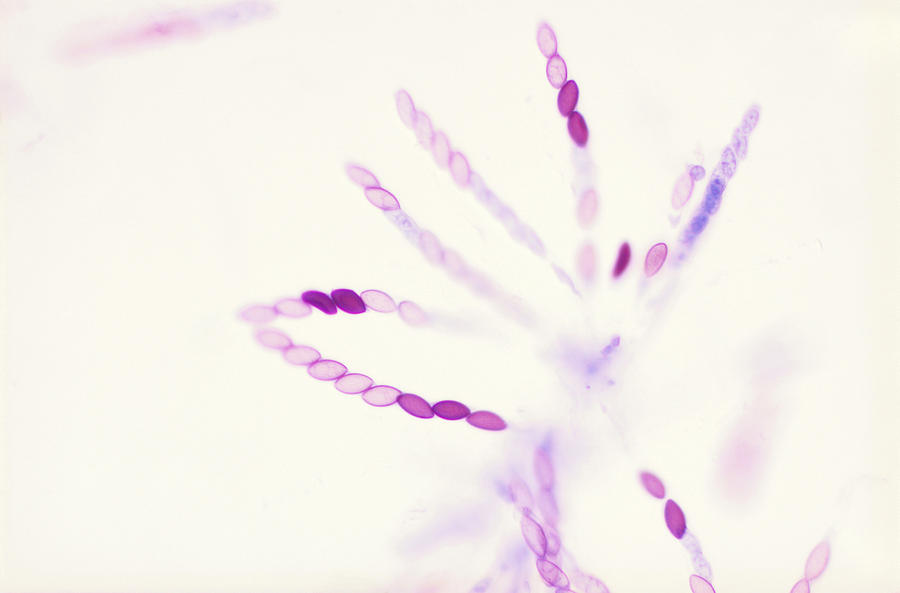 Neurospora Sp Photograph by Biology Pics