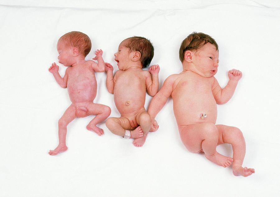 Baby Photograph - Normal Baby And Two Low Birthweight Babies by Ron Sutherland/science Photo Library