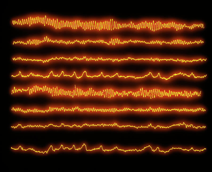 Normal Eeg Pattern (8 Channels) Photograph by Science Photo Library