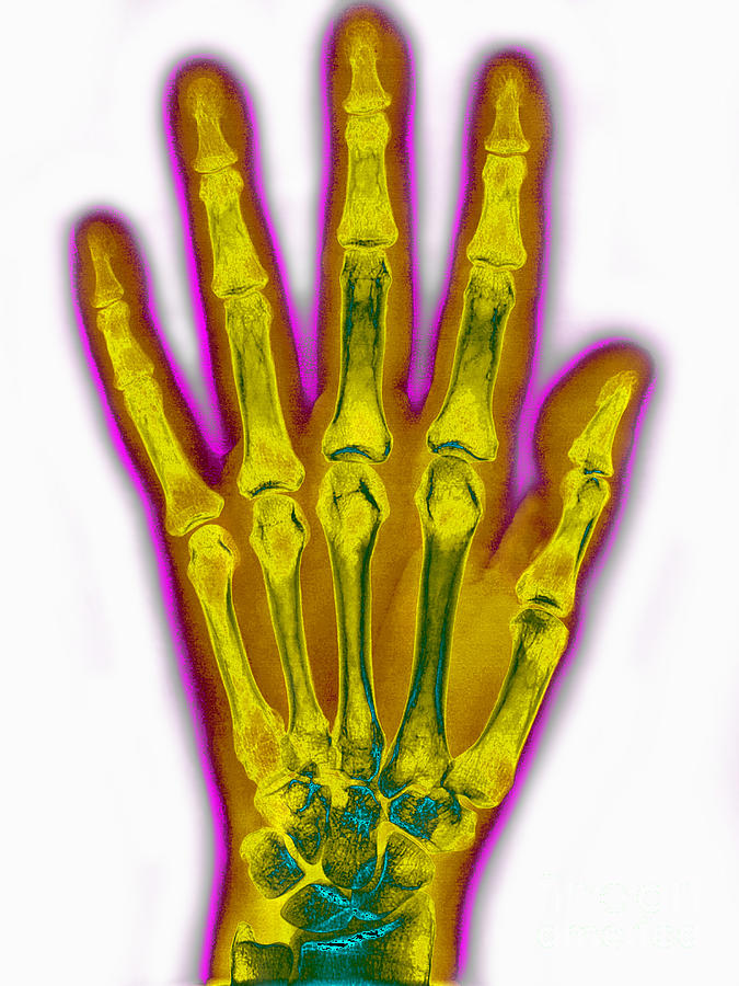Unique Photograph - Normal Hand X-Ray by James Cavallini