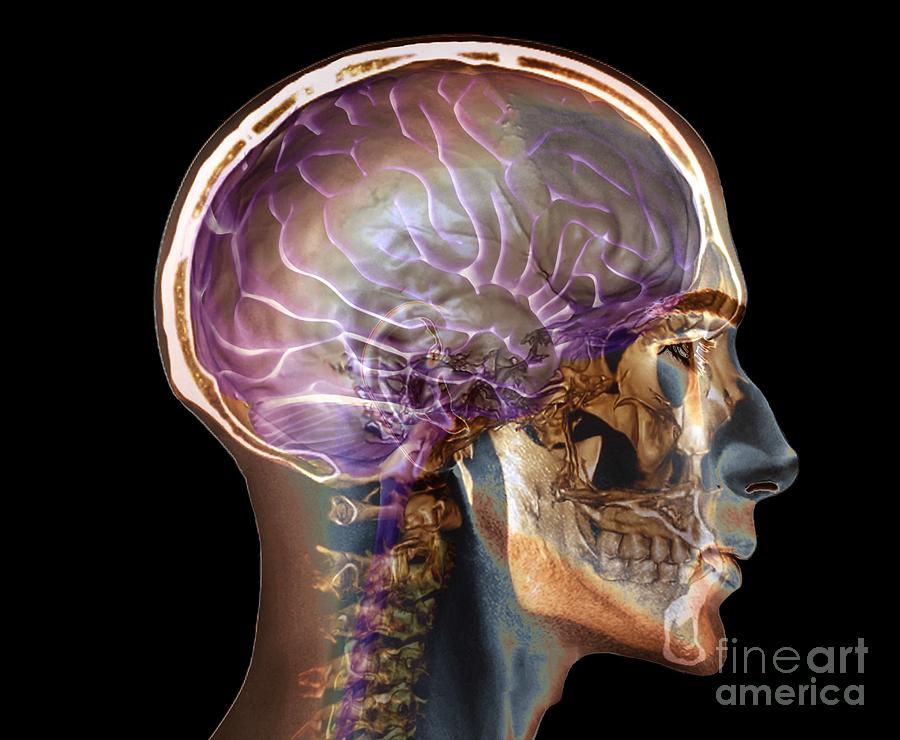 normal neck ct scan