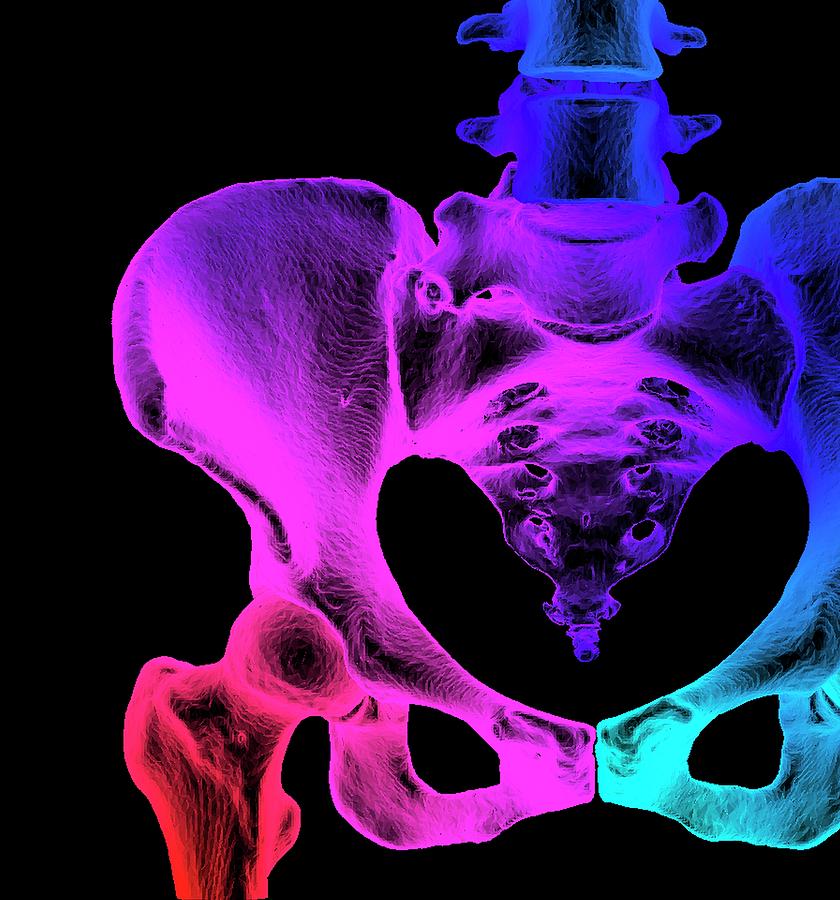 Normal Hip And Pelvis Photograph by K H Fung/science Photo Library