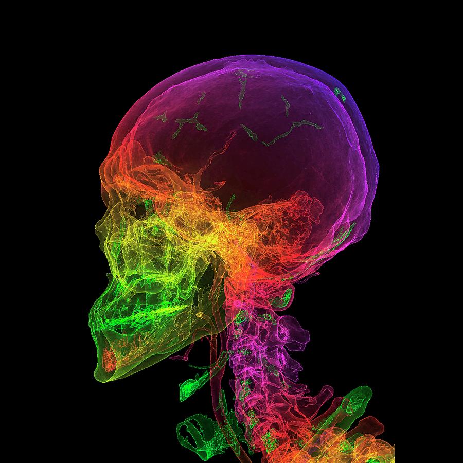 Normal Human Skull Photograph by K H Fung/science Photo Library - Pixels