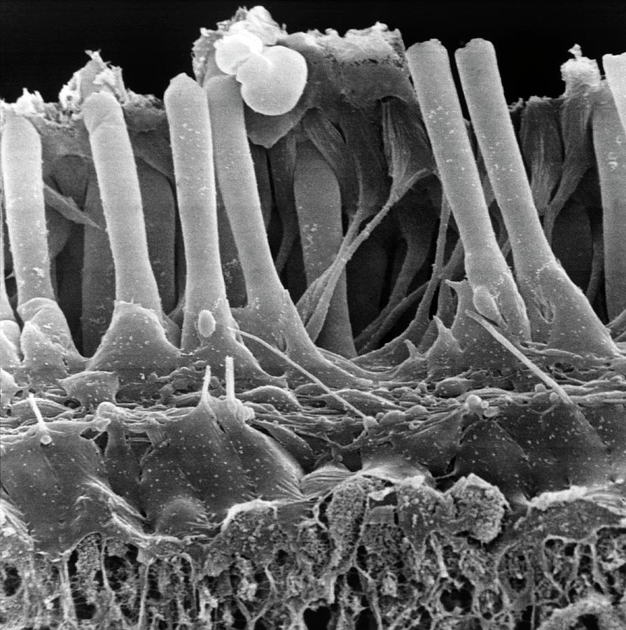Normal Inner Ear Hair Cells Photograph by Dr Goran Bredberg/science Photo Library