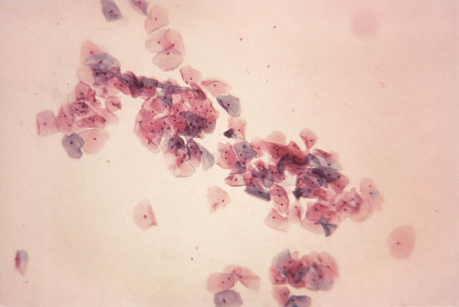Normal Pap Smear, Lm Photograph by AFIP/Science Source