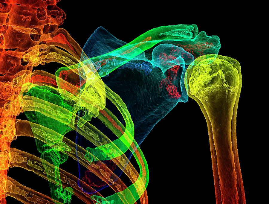 Normal Shoulder Photograph by K H Fung/science Photo Library
