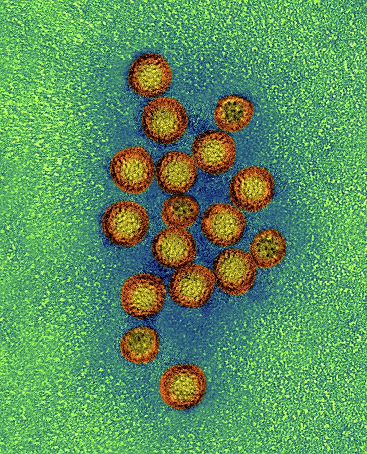 what is norovirus virus