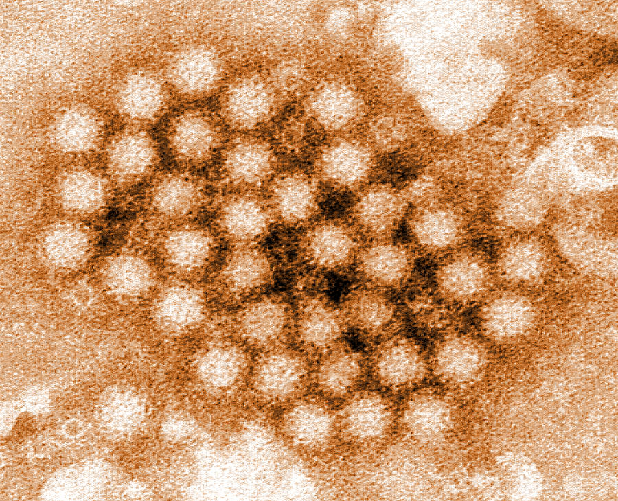 Norovirus, Tem Photograph by Science Source