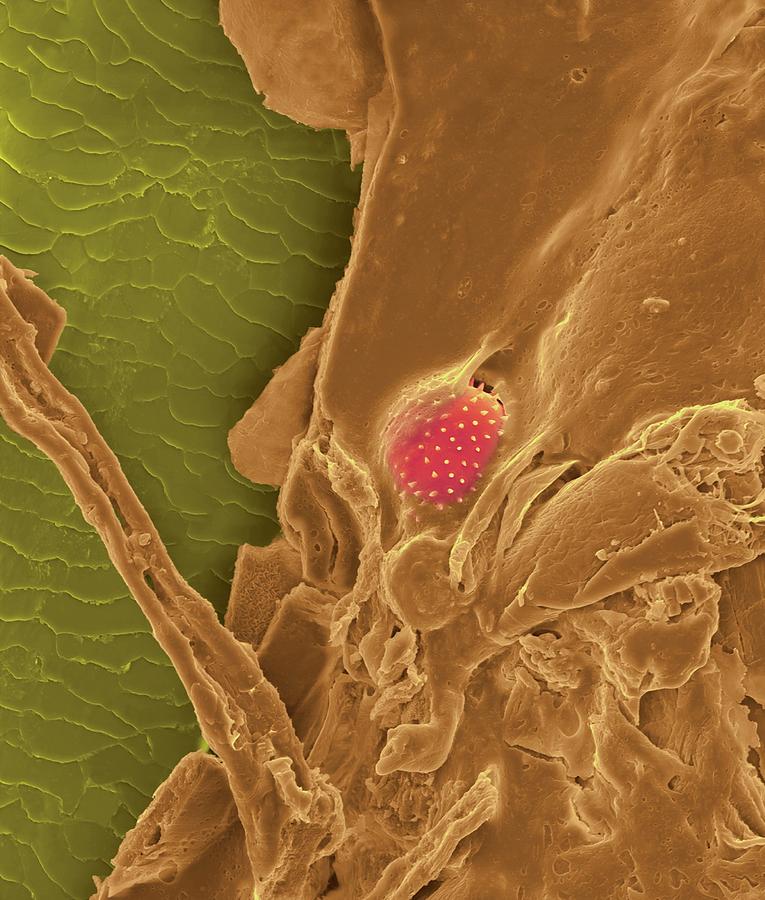 Nose Hair With Mucus And Trapped Pollen Grain Photograph by Dennis Kunkel Microscopy/science Photo Library