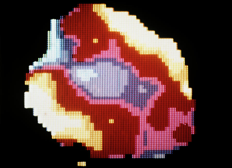Heart Scan Photograph - Nuclear Angiogram Of A Normal Human Heart by Science Photo Library. Heart Scan Photograph - Nuclear Angiogram Of A Normal Human Heart by Science Photo Library.