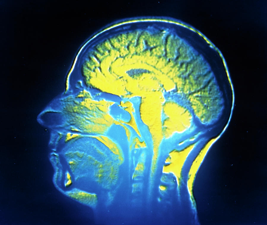 Nuclear Magnetic Resonance Image Of The Human Head Photograph by Cnri ...