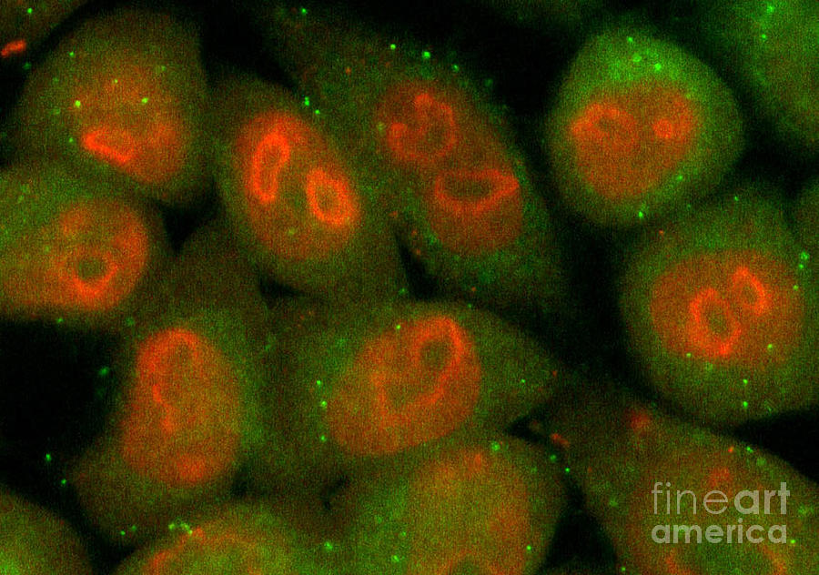 Tumor Photograph - Nucleolin Confocal Micrograph #1 by Voisin Phanie
