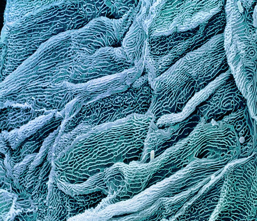 Oesophagus Epithelium Photograph by Science Photo Library Oesophagus Epithelium Photograph by Science Photo Library