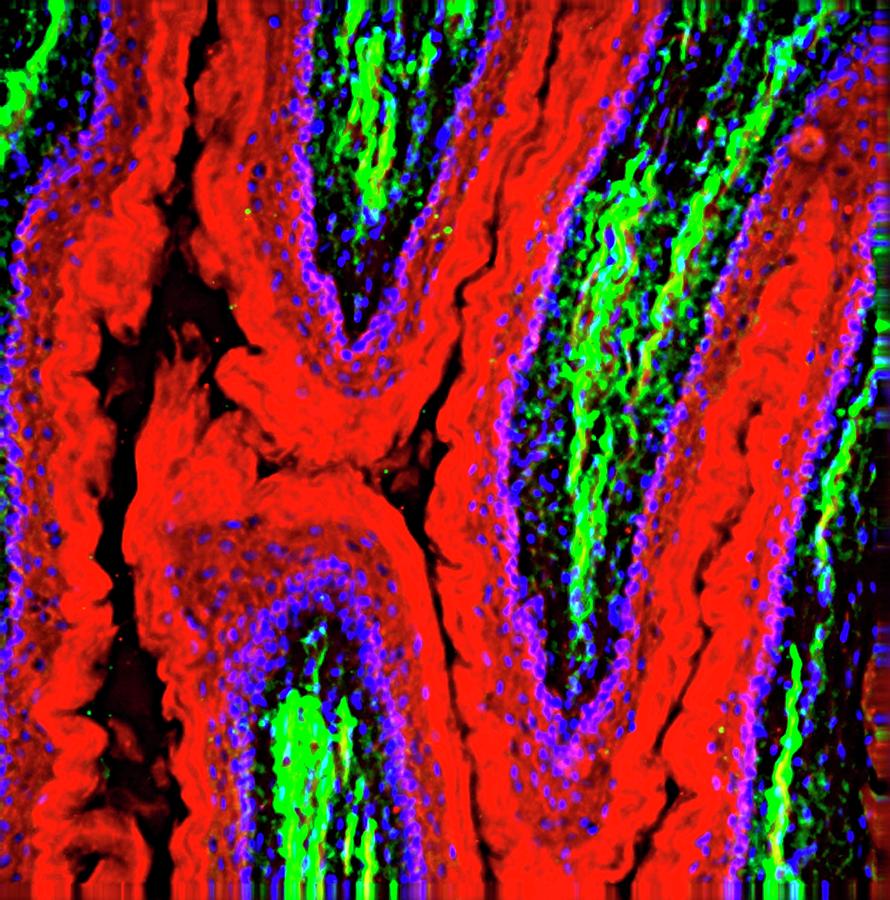 Oesophagus Lining Photograph by R. Bick, B. Poindexter, Ut Medical ...