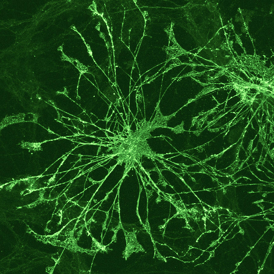 Oligodendrocyte Nerve Cells Photograph by C.j.guerin, Phd, Mrc Toxicology Unit/ Science Photo Library
