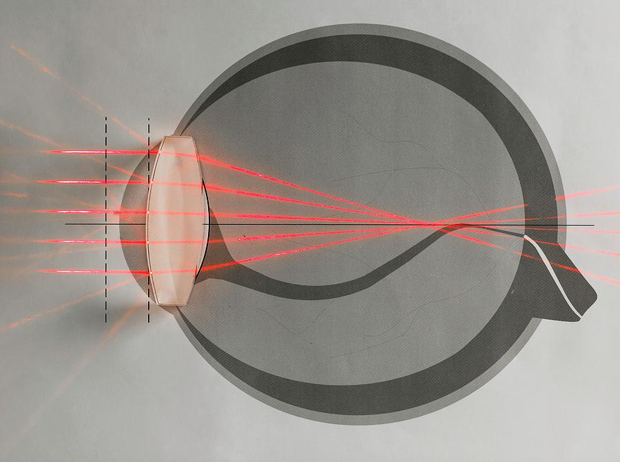 Optics Of Near-sightedness Photograph by Science Photo Library
