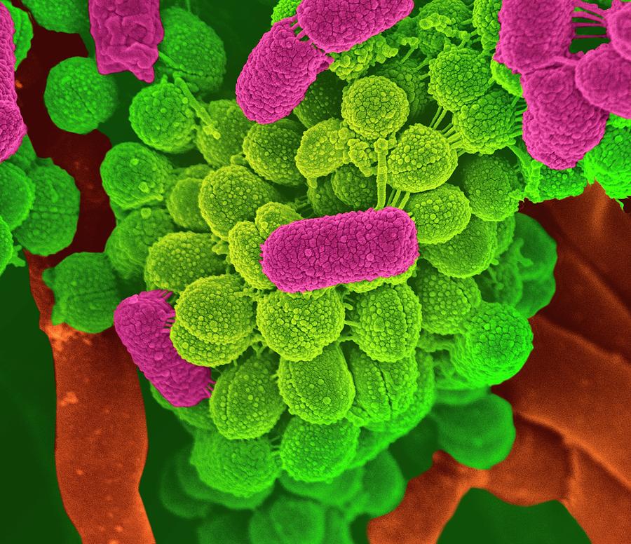 Oral Bacteria Photograph by Science Photo Library - Fine Art America