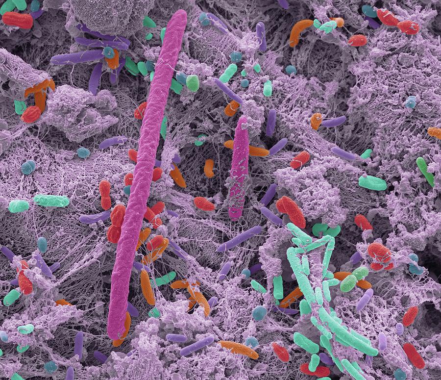 Oral Bacteria Photograph by Steve Gschmeissner/science Photo Library